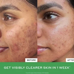 Ole Henriksen BALANCE Violet Ice Cold Plunge Pore Mask