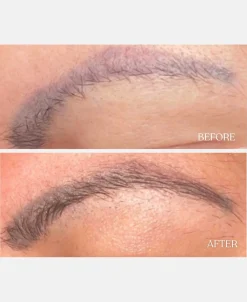 Brynserum><noscript><img width=