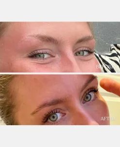 Brynserum><noscript><img width=