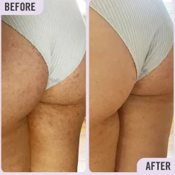 Sephora Collection DAILY ESSENTIALS KP BODY SCRUB 10%