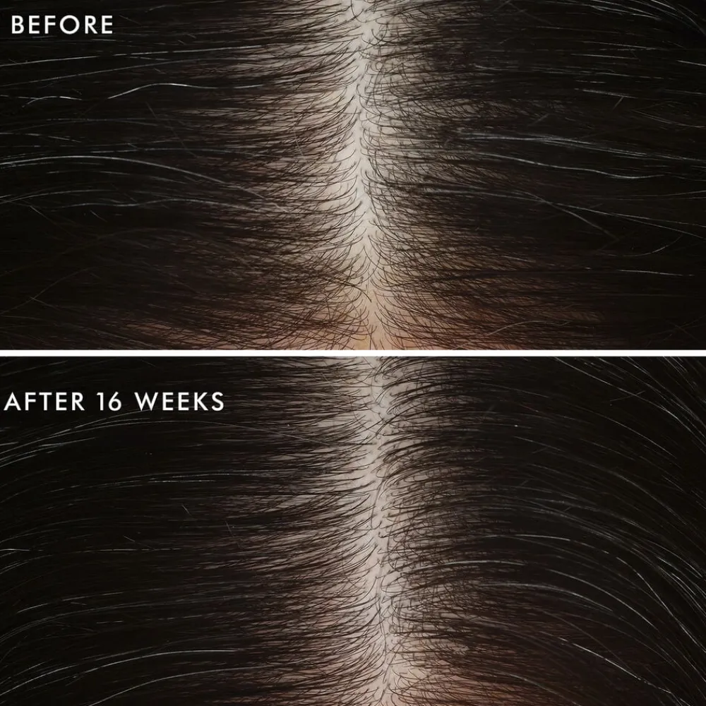 Revitalizing Scalp Tonic 100 ml.>Moroccanoil