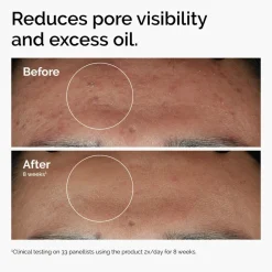 Niacinamide 10% + Zinc 1% 30 ml. Serum><noscript><img width=