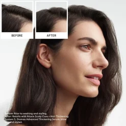 System 3 Loyalty Kit>NIOXIN Sale