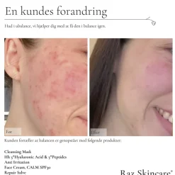 Raz Skincare Repair Salve 15 ml Best