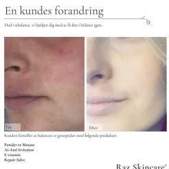 Raz Skincare Repair Salve 15 ml Best