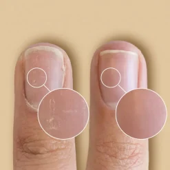 CND SolarOil Nail & Cuticle Treatment PEN